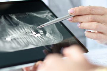 Kieferchirurg erklärt Patientem sein Röntgenbild