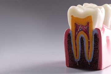 Zahnmodell des Zahnapparates mit Wurzelspitzen